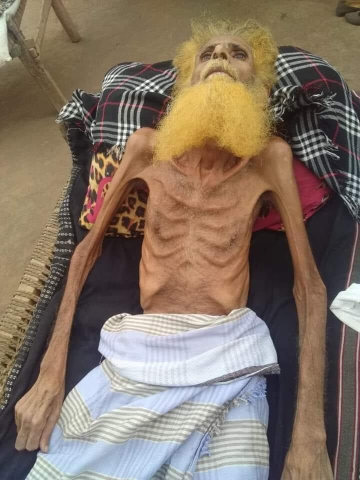 Binali285's tweet photo. اكتبو عن اليمن وانقلوا مأساته ..

#EndYemenSiege https://t.co/7u8s8PXBq7