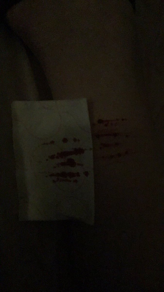 thunderxsid's tweet photo. tw// self harm/ blood
-
-
-
-
-
-
-
-
-
-
-
-
-
-
-
-
-
so... i’m kinda in love with these ngl also sorry the second picture is such bad quality my lighting is super bad lmao #shtwt #selfharm #proselfharm (not really just a tag) https://t.co/gsOCQknCYz