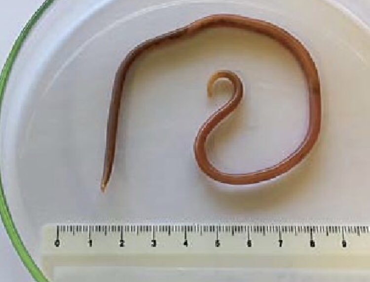 Круглые черви фотографии. Аскарис Люмбрикоидес яйцо. Аскарида lumbricoides цикл.