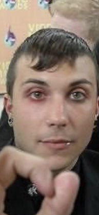 pictures of frank where he looks like a bug and i mean this as lovingly as possible
