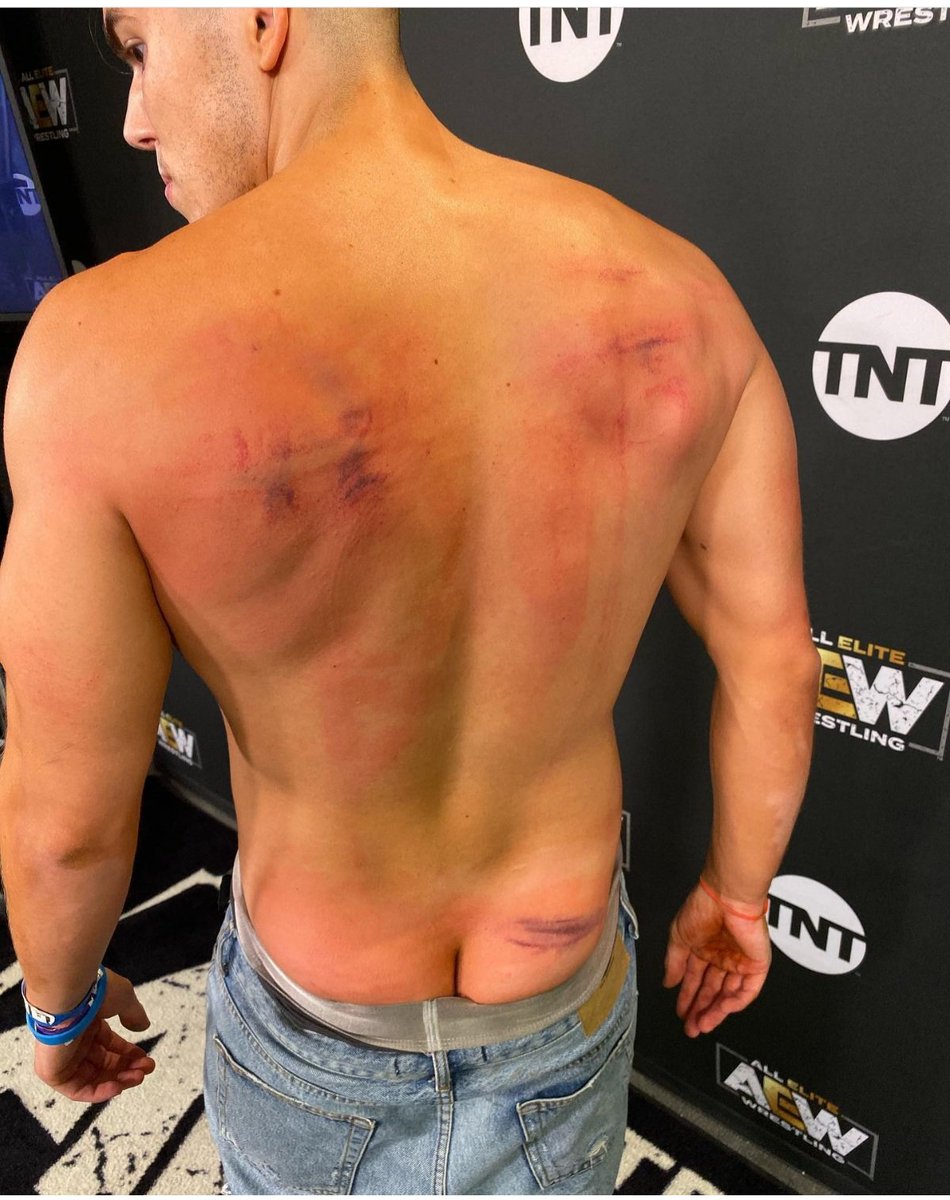 BulgeYoutuber's tweet photo. Mmm Sammy Guevara with a bit of ass showing https://t.co/eVdwXNGzRj