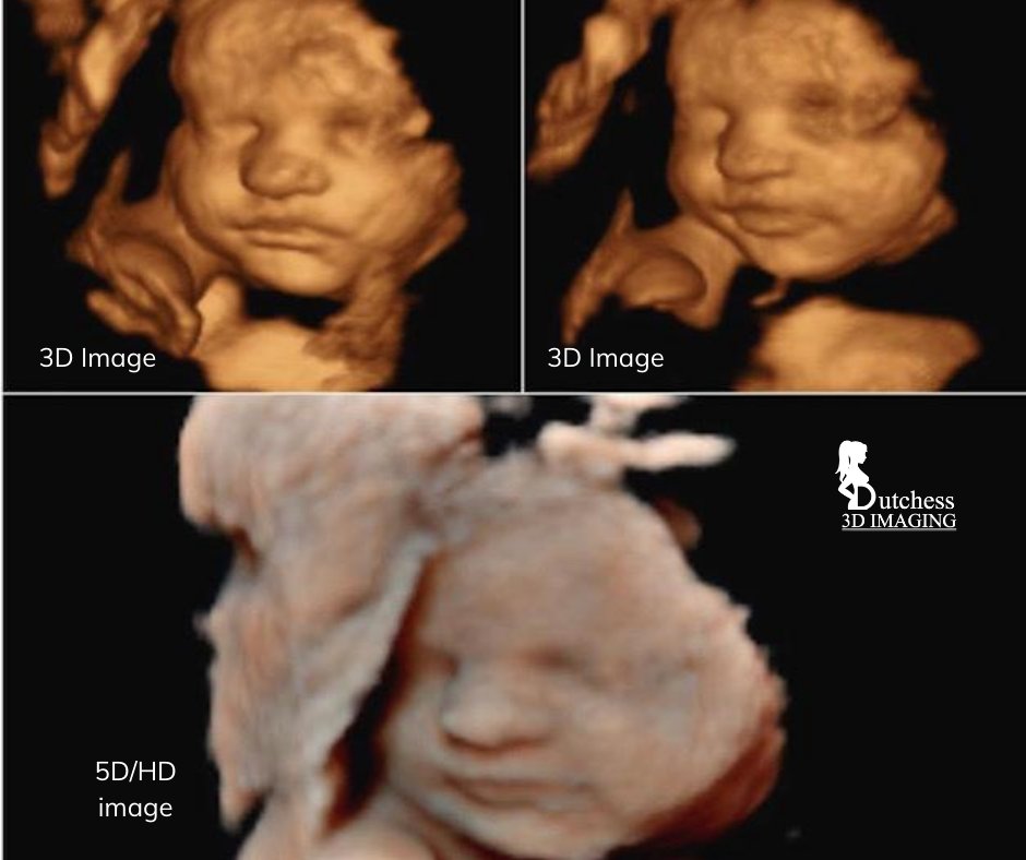 Southern Dutchess County 3D / 4D Ultrasound Imaging & Baby Boutique