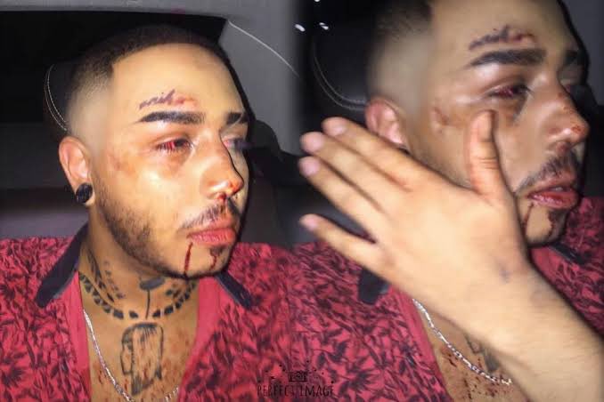 Queria ver levantarem tag para isso.  Somente em 2018, Brasil registou mais de 12mil crimes de &oacute;dio e<a href="/tag/detalheslgbtq"class="tags"><span>#detalheslgbtq</span></a>