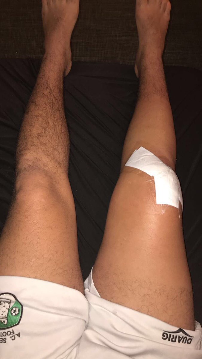 Petite photo de mon genou après l’opération. 