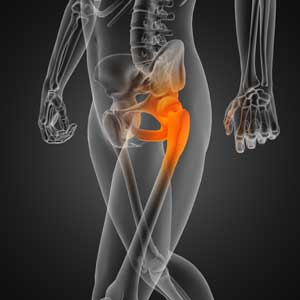BSRPT's tweet photo. Hip arthritis does not have to be disabling. Exercise will improve your pain, function, and quality of life. Meet with your physical therapist to develop an individualized exercise program that is best your needs. #ExerciseIsMedicine #MoveWithoutPain https://t.co/5gJxaBj7l3 https://t.co/1XcbXa3oBz