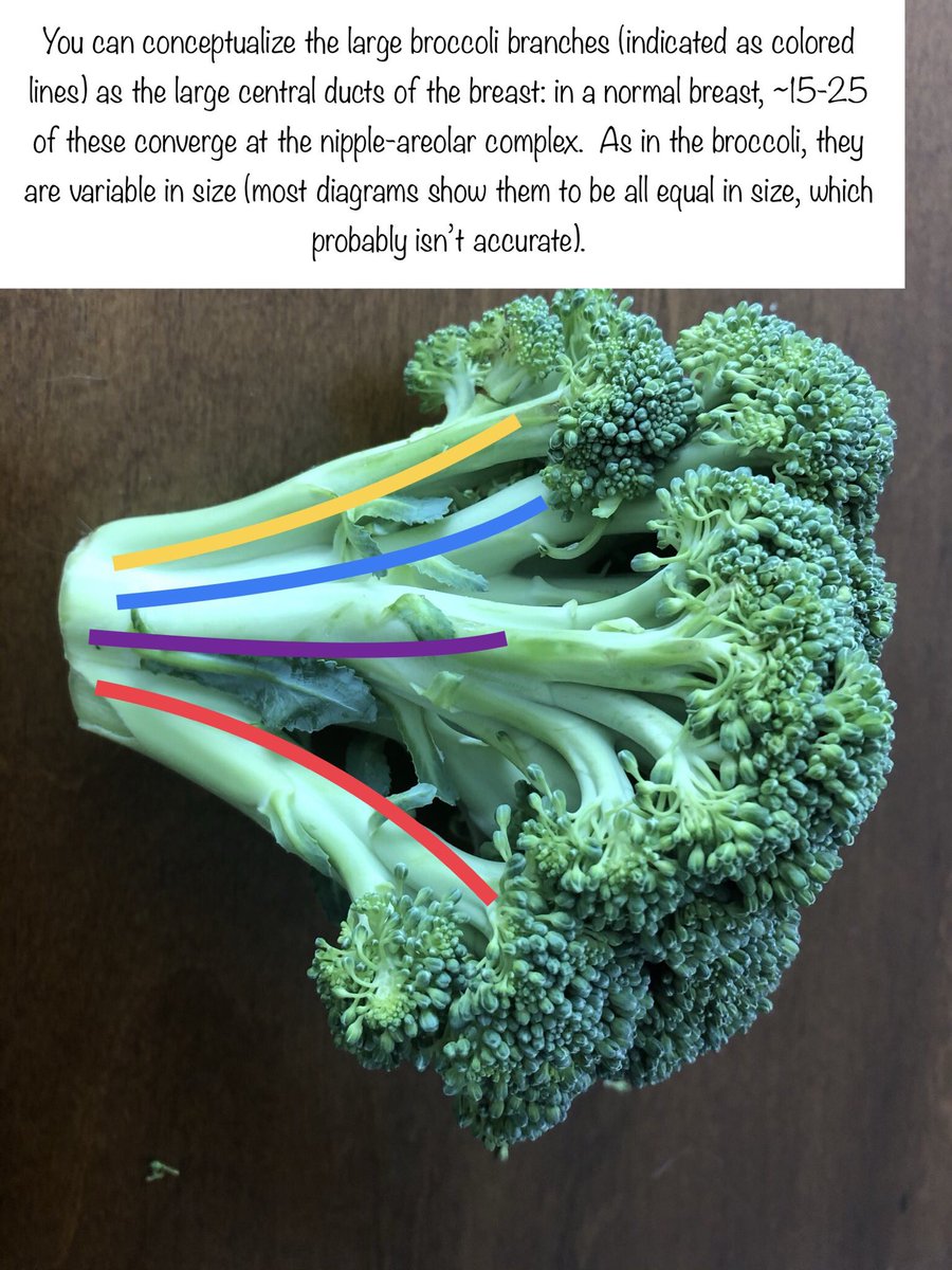 2. A cruciferous conception of the breast ductal/lobular system:Each large branch (colored lines), along with its ramifications, defines a breast lobe. Conceptually important, but not easily identifiable anatomically.
