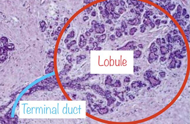 4. Terminal ductular lobular unit: the end part of the broccoli. Picture the lobule as the little green nub at the very end.TDLU pic: https://www.google.com/amp/s/slideplayer.com/amp/5988133/