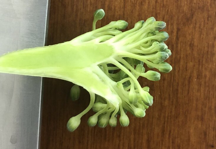 4. Terminal ductular lobular unit: the end part of the broccoli. Picture the lobule as the little green nub at the very end.TDLU pic: https://www.google.com/amp/s/slideplayer.com/amp/5988133/