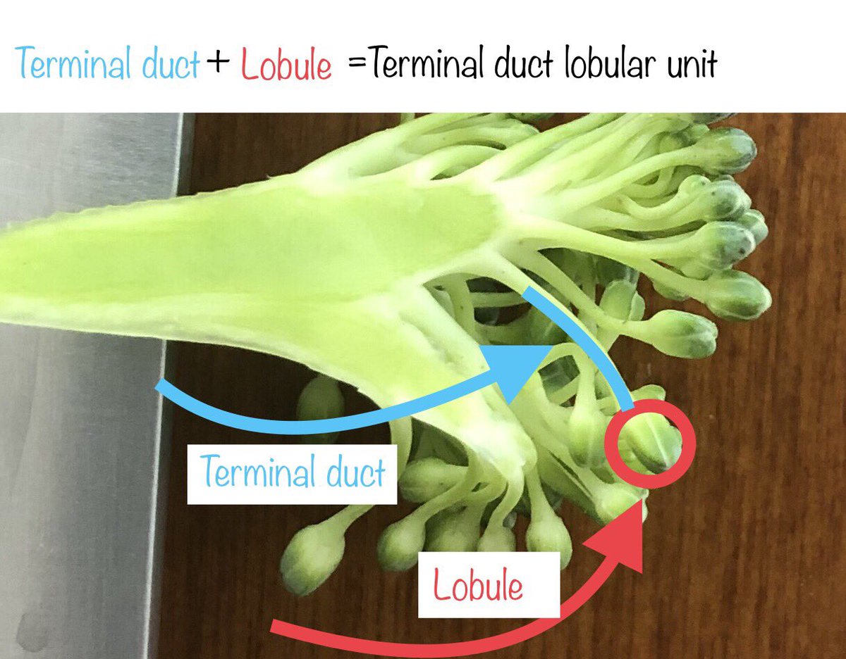 4. Terminal ductular lobular unit: the end part of the broccoli. Picture the lobule as the little green nub at the very end.TDLU pic: https://www.google.com/amp/s/slideplayer.com/amp/5988133/