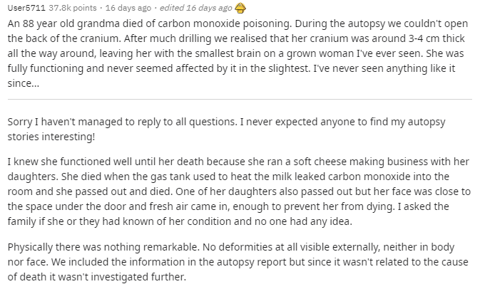 there was a reddit thread about a woman whose skull was absurdly thick, a fact only discovered upon autopsy and completely unrelated to her cause of death in her late 80sno apparent delays in intellect or functioning