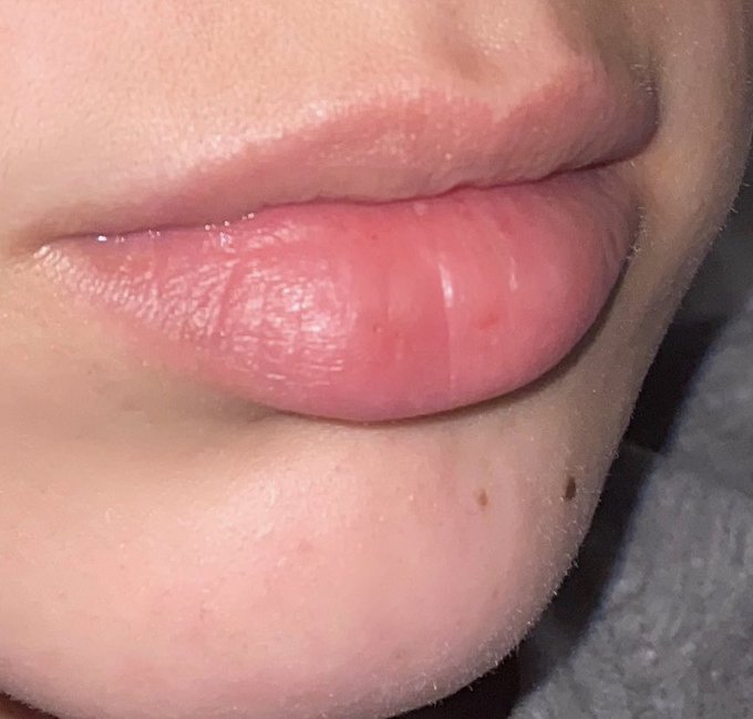 Here&rsquo;s an example of what I mean😂like god was like let me give you all the lip in your bottom lip🤣 https://t
