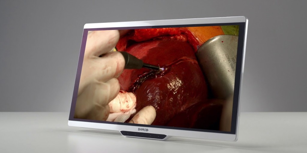 BarcoHealth's tweet image. Do you enjoy fabulous 4K in your OR yet? 🤩
Discover our 4K resolution surgical displays: ow.ly/JWEt50B4w6H

#4K #surgicaldisplays #surgicalimaging #operatingroom

ow.ly/tMMe50B4w6I
