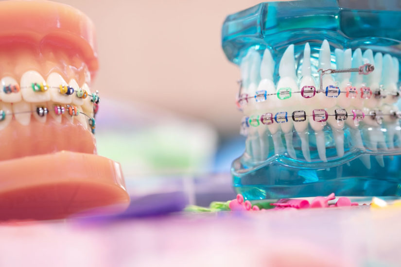 Riya_jd's tweet photo. #webinaralert

Session on Orthodontics

To engage yourself in the session on #orthodontics, visit:  https://t.co/8ktwKJlng8

For further queries, kindly contact us through whats app: +44 330 808 0214

#dental #webinars2020 #dentistry #oralhealth #COVID19 https://t.co/70hhu0tr0E