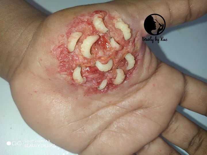 Malawian SFX Makeup artist •Trainer on X: Maggot infested wound Sfx  woundagain, this is just make up not real..the maggots were hand made  from scar wax. #sfx #sfxmakeup #maggotsfxmakeup #infectedwound #sfxmua  #sfxhorror #