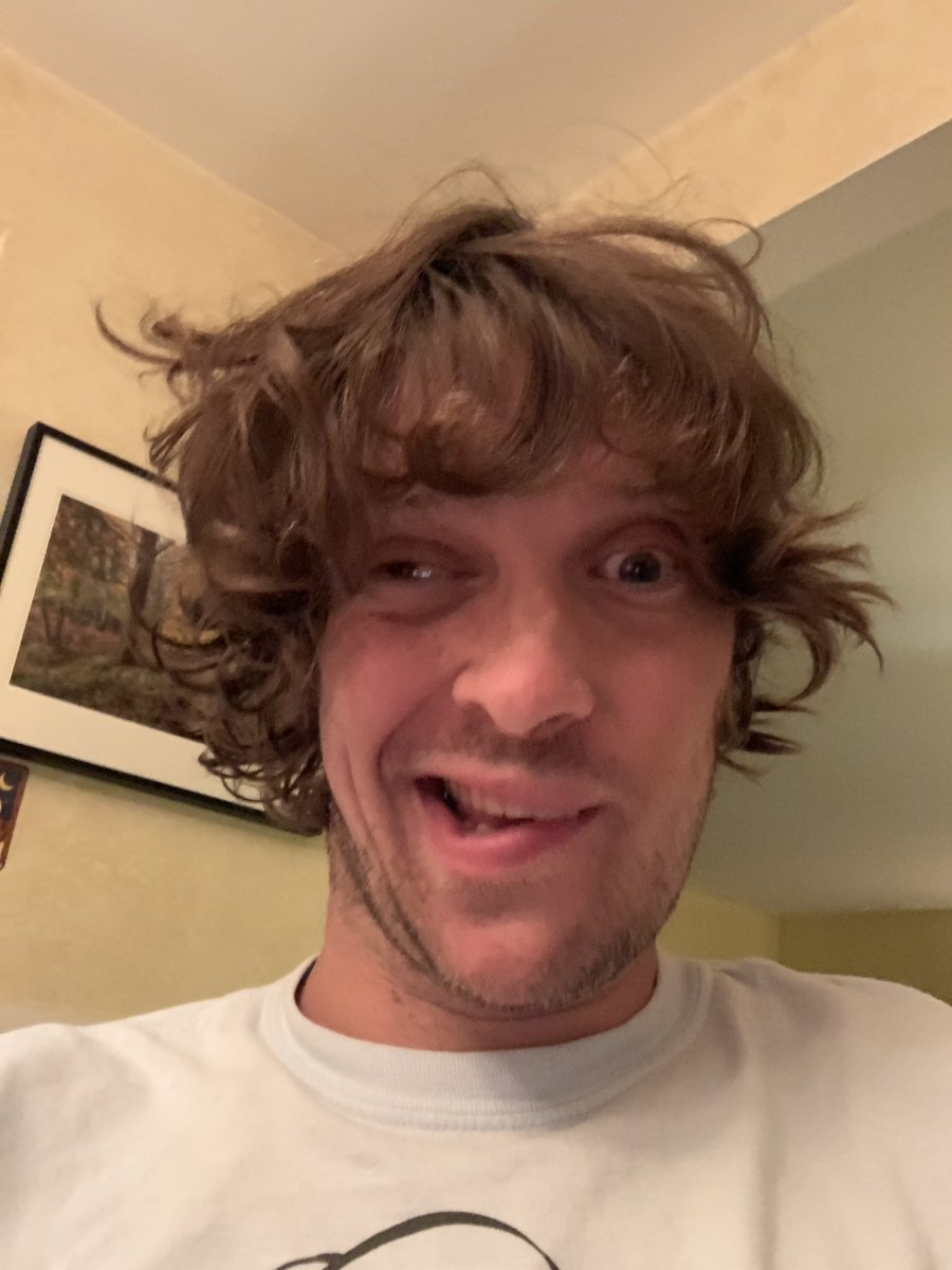 Zachanner's tweet photo. Bad news: I was in the ER all day.
Good news: I’m fine and I got a new palsy! This is how I smile now!#BellsPalsy  #DoublePalsy #IAmAPirate https://t.co/Dg9YkoNTw4
