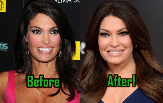 tapdancer195's tweet photo. @stinchfield1776 @kimguilfoyle Yuck https://t.co/6dFNuDzhZR