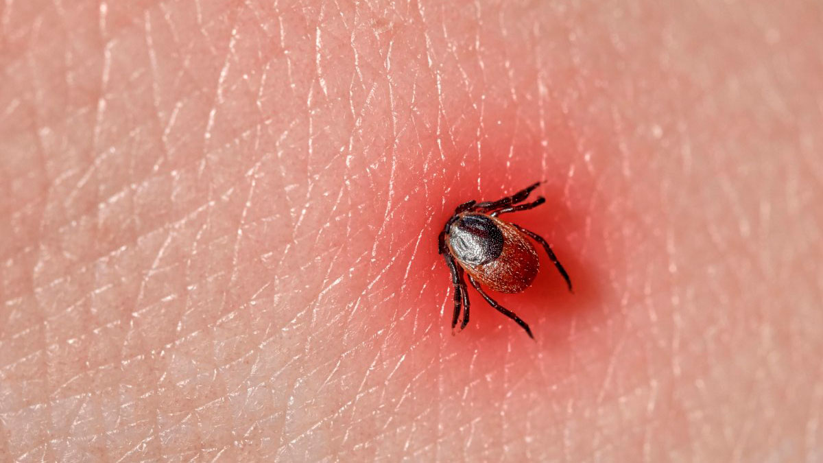 Теперь в Самарской области исследования снятых с пациентов клещей на наличие вируса энцефалита и боррелиоза проводятся только платно: на энцефалит - 612,48 руб., на боррелиоз - 650,98 руб.
Причина: минздрав СО исключил эти исследования из тарифного соглашения в системе ОМС.