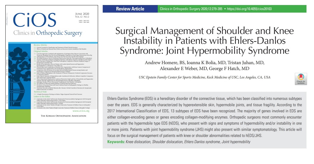 CiOSjournal's tweet photo. Surgical Management of Shoulder and Knee Instability in Patients with Ehlers-Danlos Syndrome
#Clinics_in_Orthopedic_Surgery 2020 Sep
#Korean_Orthopaedic_Association
https://t.co/c3x028Rjiv
#Knee_dislocation #Shoulder_dislocation #Ehlers_Danlos_syndrome #Joint_hypermobility #CiOS https://t.co/WiVCoX525P