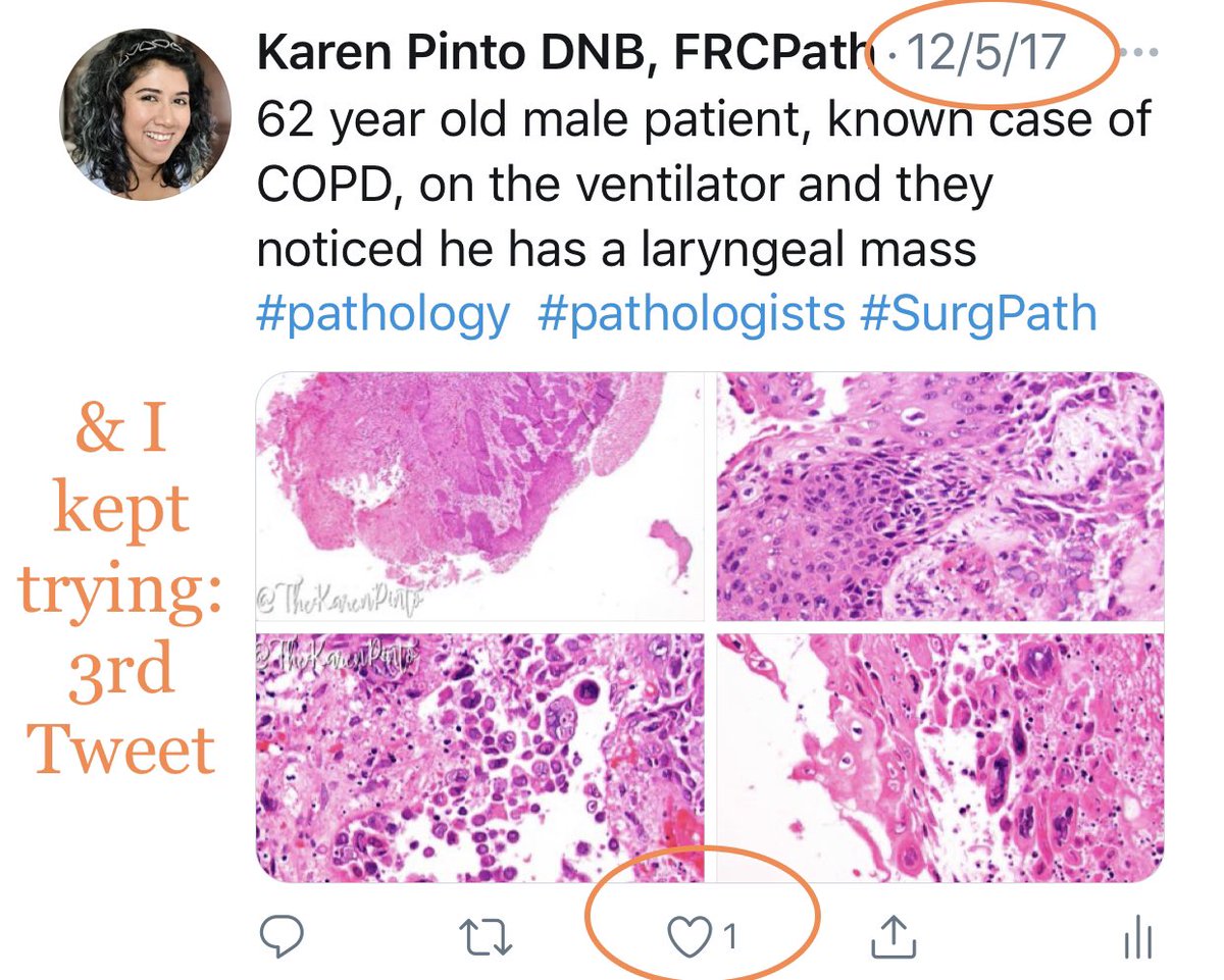 My  #PathTwitter journey: If any of you feel:-your tweet isn’t good enough -no one will notice-I have nothing interesting to post-I’m so inexperienced use my journey as an example All you need to do, is keep trying  #pathology  #PERSISTENCE