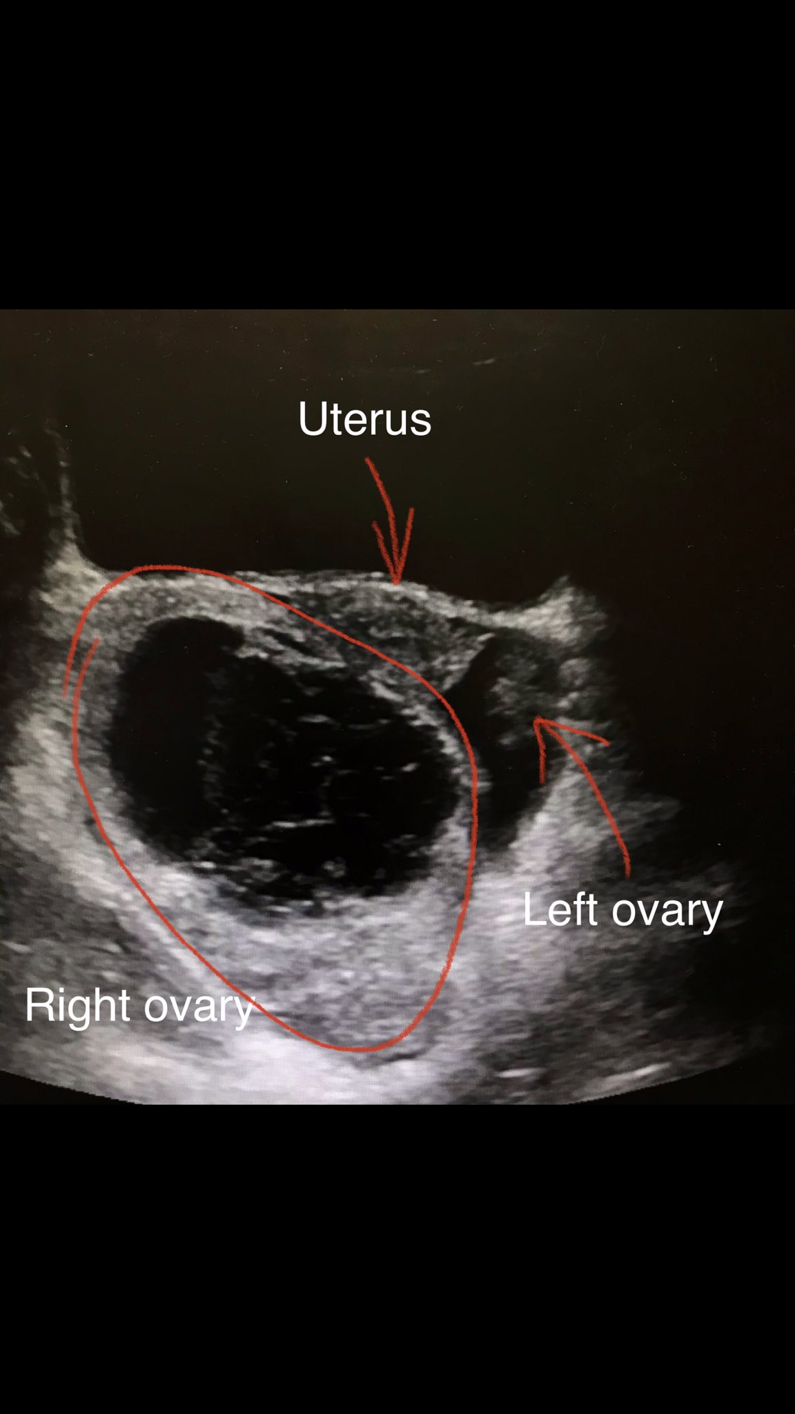 Sonographic_Tendencies on Twitter "Ultrasound usually shows an