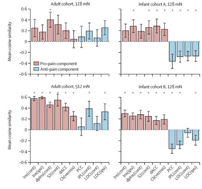 MoultrieFiona's tweet photo. Advancing our understanding of pain in infants using fMRI-based signatures of evoked brain activity! Delighted to see our work in print in @LancetDigitalH. Well done team! @EugenePDuff @alexx_abos  @spfitzgibbon @torwager @UniofOxford  https://t.co/ZF3eLVjbQj https://t.co/kN4uDpKFob