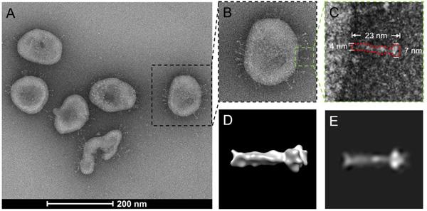 La segunda, menos evidente, pero igualmente ilustrativa, es su microfotografía. Tenemos por doquier, y cualquier laboratorio con el instrumental adecuado, personal formado y acceso a pacientes infectados podría conseguirlas: