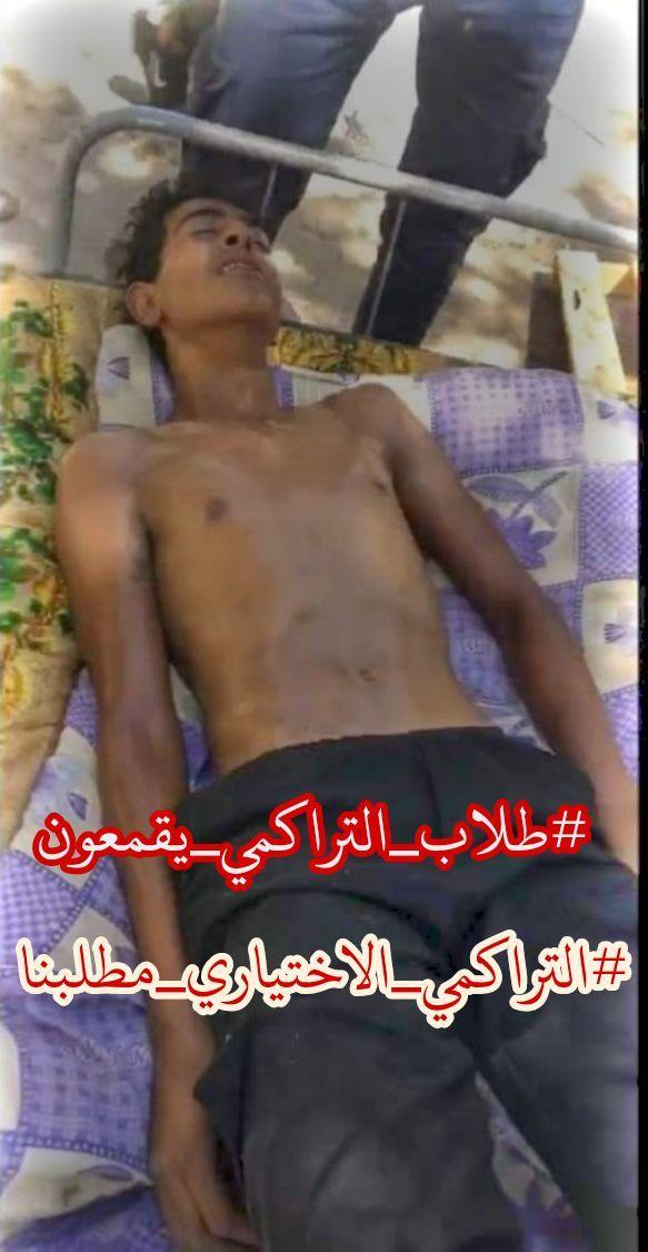 msem65341978's tweet photo. #طلاب_التراكمي_يقمعون https://t.co/isrv0BepDD