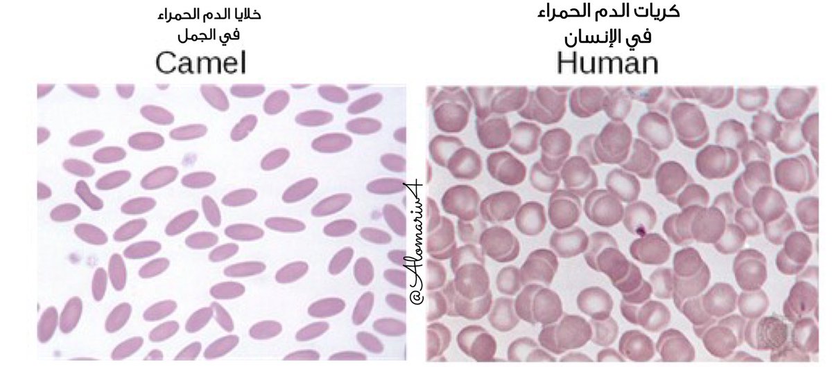 الدم الحمراء خلايا شكل الأنيميا (فقر
