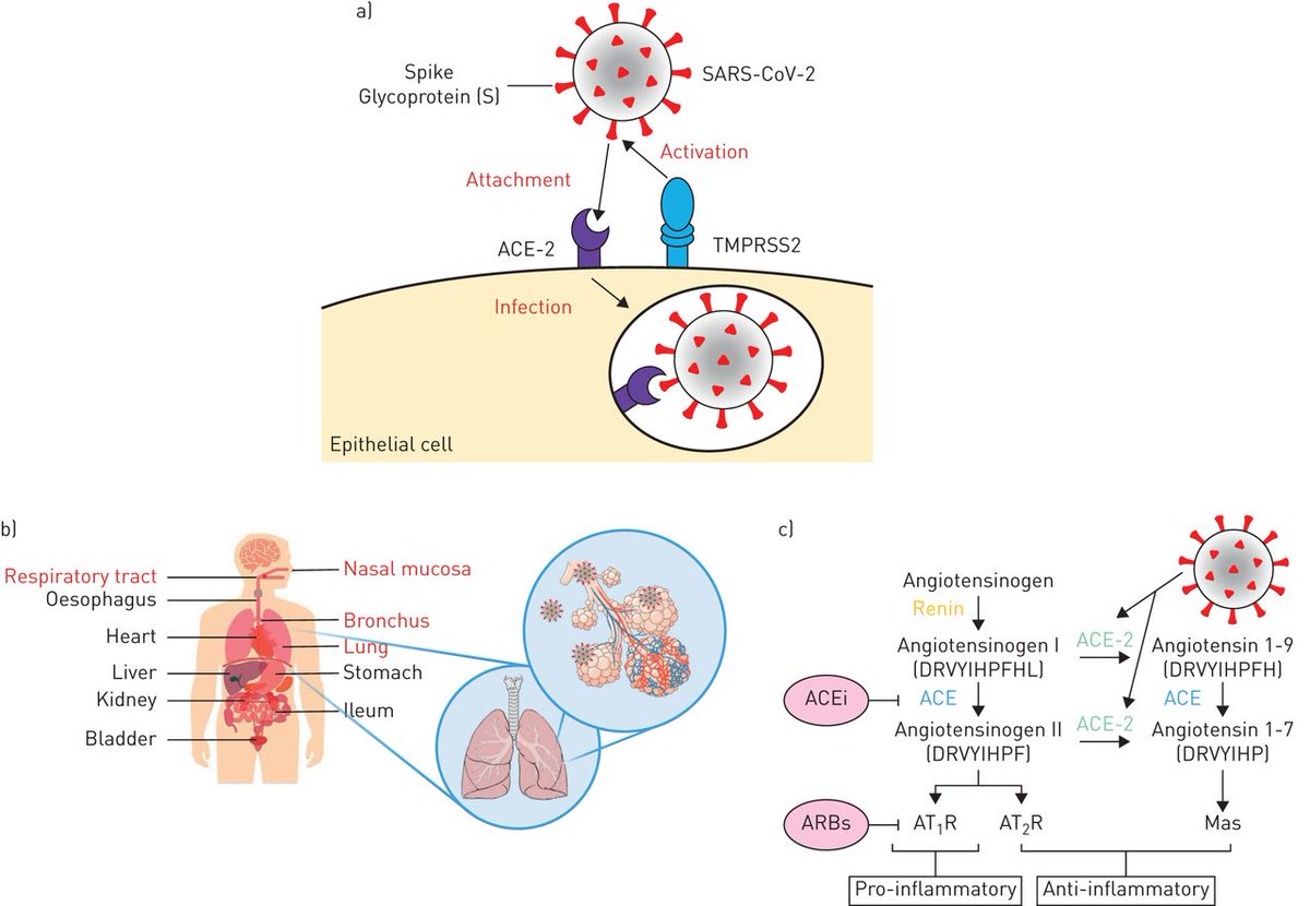COPD patients have increased risk of severe pneumonia and poor outcomes when they develop #COVID19. This may be related to poor underlying lung reserves or increased expression of ACE-2 receptor in small airways. bit.ly/37dSB8l