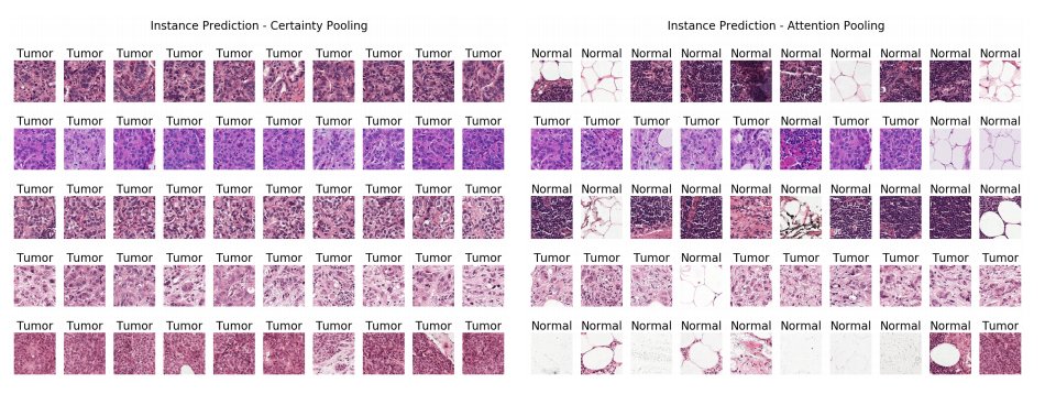 Check out the new paper on "Certainty Pooling for Multiple Instance Learning". 

The "Certainty Pooling" method was applied to the Camelyon16 Lymph Node Metastasis Detection data and outperformed other methods. 

The paper can be found here: lnkd.in/dvWK9Un