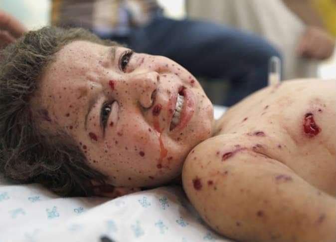 AyaIsleemEn's tweet photo. Children of #Palestine ... Where is the global conscience!!!!!
#Gaza🇵🇸💔😢😢 https://t.co/bY2tRHd0jS
