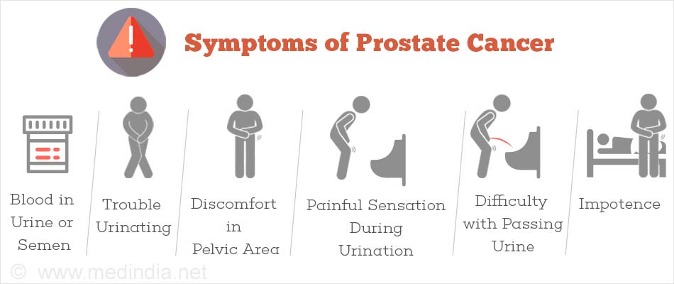 What should psa be after prostate removal What should psa be after prostate removal
