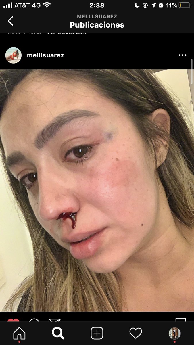 DianaGindic's tweet image. Ya estamos hartas de vivir en medio de tanta violencia. 
Hoy nuestra hermana Mel visibilizó la violencia familiar q ha vivido con su pareja. Pedimos el apoyo a las autoridades correspondientes para tomar acciones en contra de su agresor.
#JusticiaParaMell #NiUnaMas 
@mellsuarez28