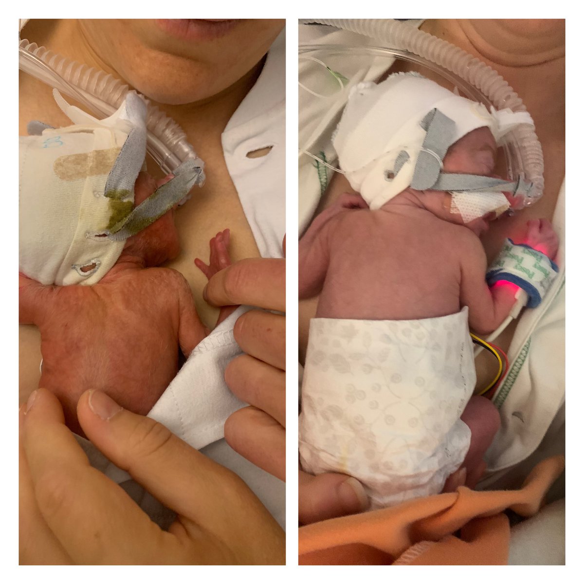 Nejmen gissa vem som är över 1000g? 4 veckor av känslostormar, lycka, oändlig kärlek 🌈 #extremprematur