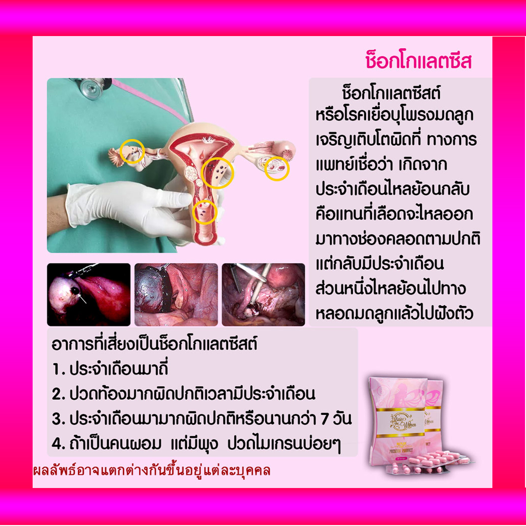rixieao's tweet photo. เยื่อบุโพรงมดลูกเจริญผิดที่
ภาวะนี้เกิดขึ้นที่รังไข่ท่อนำไข่ กระเพาะปัสสาวะ หรืออุ้งเชิงกราน ทั้งนี้ อาจเกิดที่ลำไส้ กะบังลม ตับ ปอด หรือที่สมอง ซึ่งเป็นกรณีที่ร้ายแรง
#ตกขาวมีกลิ่น #คันในช่องคลอด #ปวดท้องประจำเดือน #ริกซี่ #Rixie
✅ติดต่อสอบถามทางไลน์
👉https://t.co/nDTfB1b8EZ https://t.co/fqHMqb4ue1