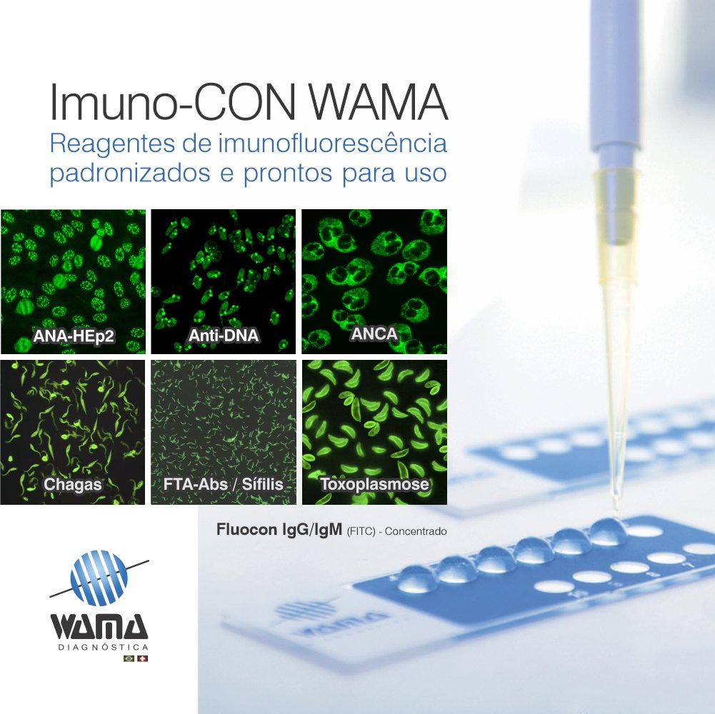 WAMADiagnostica's tweet photo. A Linha Imuno-CON oferece ao laboratório clínico reagentes padronizados e prontos para uso, garantindo qualidade nos resultados e praticidade na preparação de lâminas. https://t.co/h3K29xjxui #WamaDiagnostica #ImunoCon #Imunofluorescencia #Reagentes https://t.co/MTN6pyAo34
