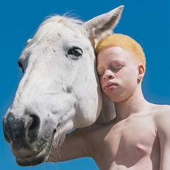 LeKiosquebyGCS's tweet photo. ...des Albinos au Congo, a appelé tous les albinos à la pugnacité en vue de transformer leur fragilité en force.
Retrouvez l’intégralité de cette interview dans #Buzzzmagazine No 21, disponible dans l’application mobile Le Kiosque By G.C&S.
https://t.co/uyE1wdk8aA https://t.co/NjUoU6fxtF