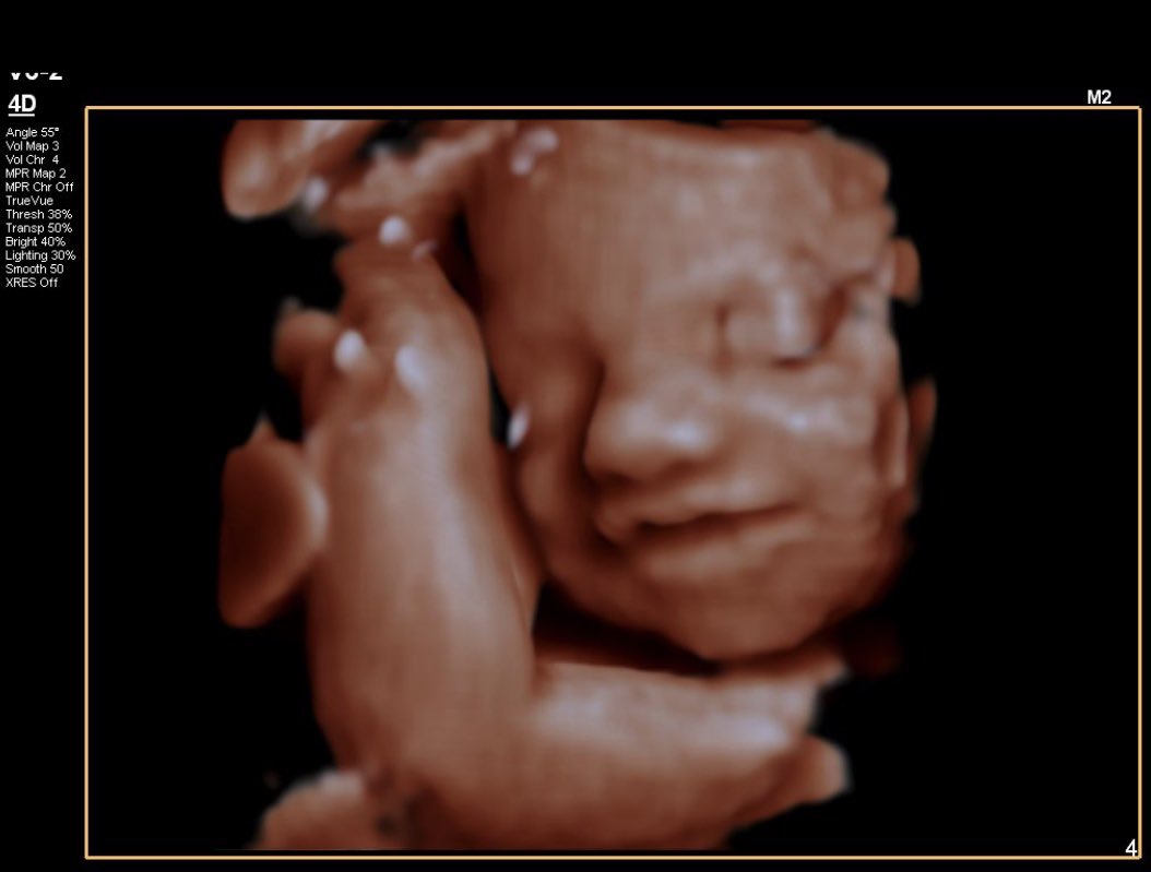 savannah_brock's tweet photo. My happy girl is 30 weeks 6 days today and weighs 3 pounds 3 ounces! https://t.co/O3q3AAkZtu