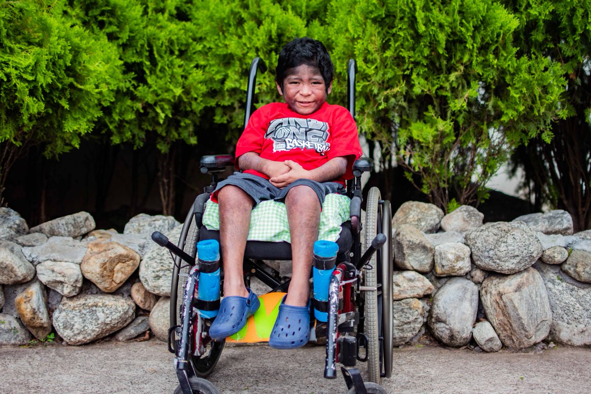 Aroldo came to HOL in March of 2018. At the time, the 7yo weighed less than 40lbs. After TWO YEARS of nutrition, occupational and skin  therapies, Aroldo is a different boy. HUGE shout out to our staff at  St. Luke's Nutritional Recovery Center!  🏥   🤒. ⛰️