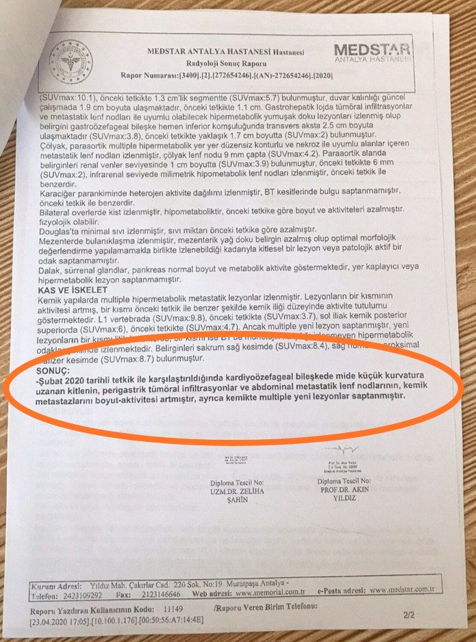 Onun hayalleri vardi.Tip okuyup Doktor olacak ve hastalari iyilestirecek, dertlere derman olacakti. 
Ayse Koca hayata gulen bir tip ogrencisiydi. Suan yataginda 4. evre kanser hastasi. 
Babasi ihrac ogretmen Ali Koca Denizli CIK'de tutuklu  7.6 ceza aldi.

 GeçTahliye Öldürüyor