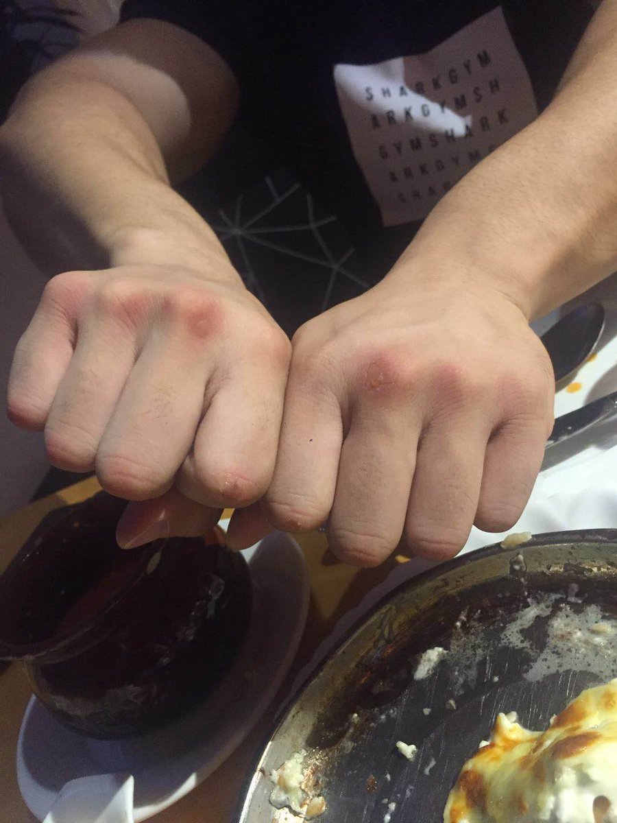 When I see a sandbag hanging and did not bring any gloves along...