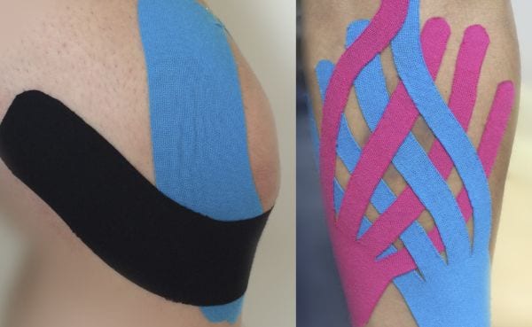 Can Kinesio Tape Help with Osteoarthritis?