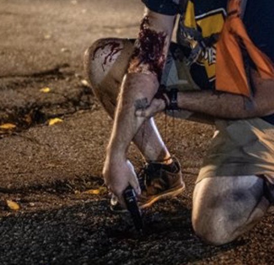 The victim of shooting number 3 (arm guy) has been identified as one Gaige Paul Grosskreutz, allegedly a felon. He can be seen in multiple pictures holding a pistol both before and after being shot: