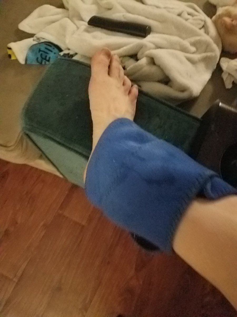 Day 5 of skateboarding!!!got a loot of ollie practice today I feel like I'm starting to get okay at it messy overall but learning a lot. by extension I rolled my ankle a goofy way and room a break halfway through. icing it now after practice