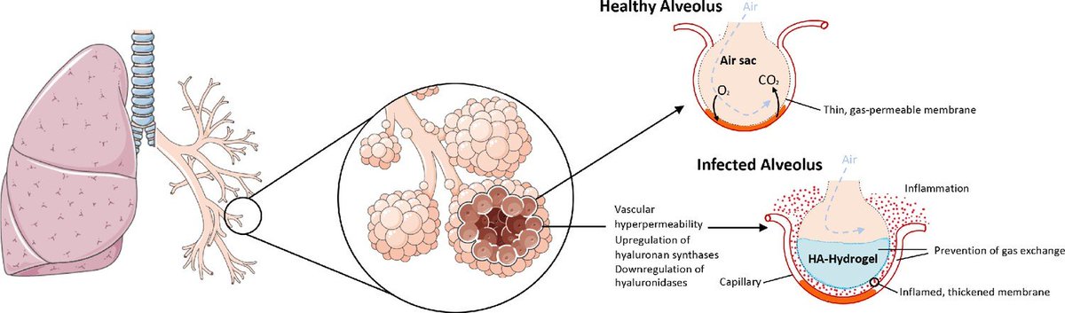 Systemic-level effects of critically imbalanced RAS and brad