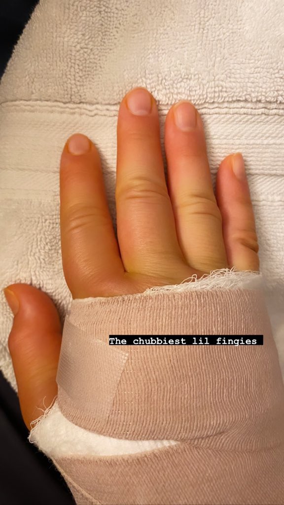 CandiceOnJoy's tweet photo. Surgery update! 
The doctor said it went well! I’m feeling pretty good, definitely some pain and the swelling has hit peak sausage link capacity 😬 thanks for your prayers!! https://t.co/DoxrYjPLIP