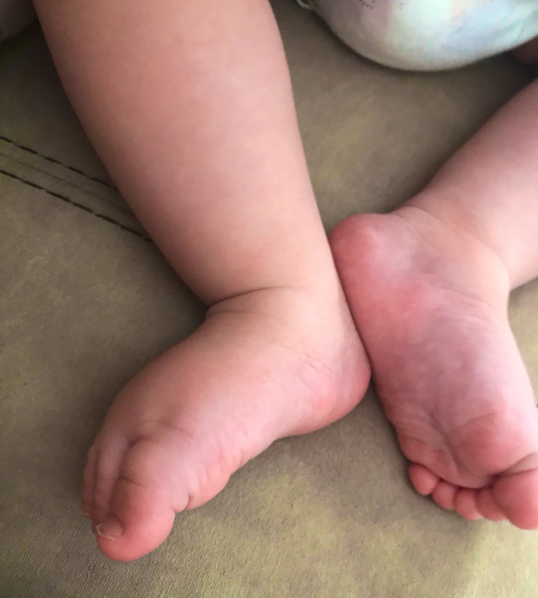 A. (@akeskinn1) on Twitter photo 