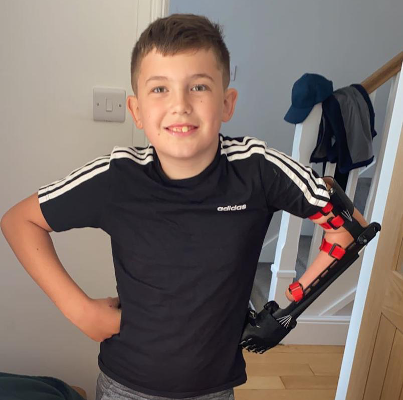 😎 Say hello to Ellis everyone. 🦾

#TeamUnLimbited #3DPrinting #LimbDifference #Technology #Positivity