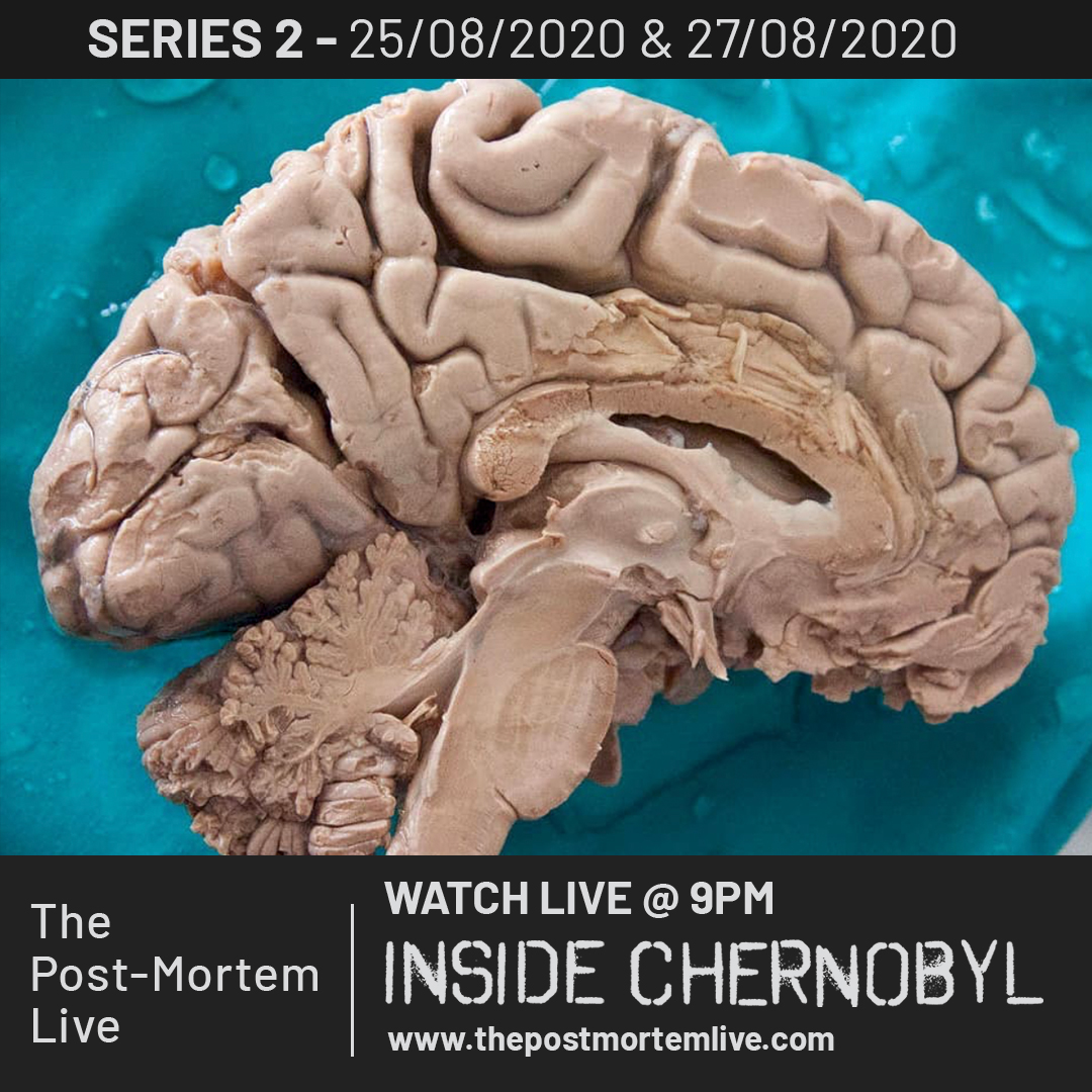 Here is a fascinating picture of the human brain, the most outstanding  organ, functioning 24 hours a day! Both episodes of The Post Mortem Live:  Inside Chernobyl are LIVE and can be, image size:1080x1080