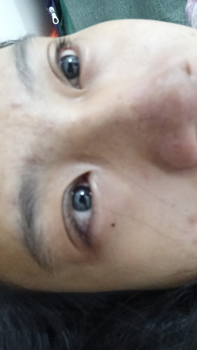 TaulitaHayati's tweet photo. Kenapa abis nangis pasti mata pegel jatuh tertimpa tangga pula #duakatagalau #kitaputus https://t.co/38gWVpJX5i